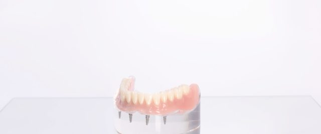 dental implants