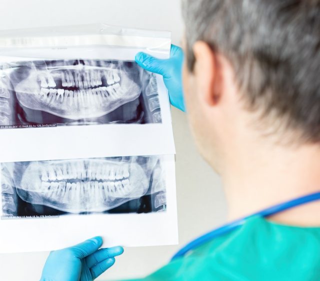 dental x-rays
